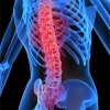 Osteoporosis: Healer or Disease?