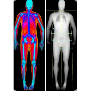 DEXA and your Muscle Weight